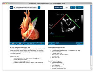 screen capture of TEE standard view web page